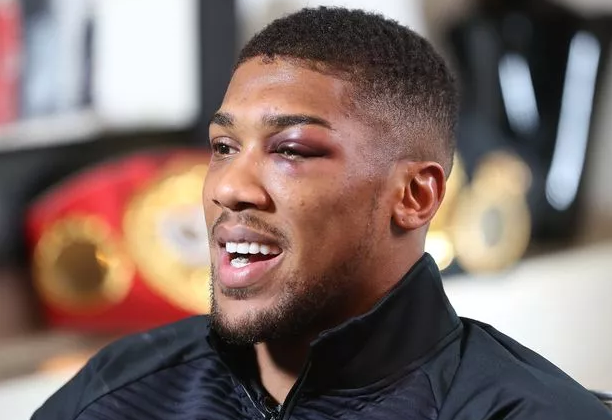 Anthony Joshua Shows Support for Dillian Whyte Against Tyson Fury